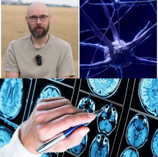 "Ho l'Alzheimer a 41 anni, è iniziato tutto quando mia...Altro...