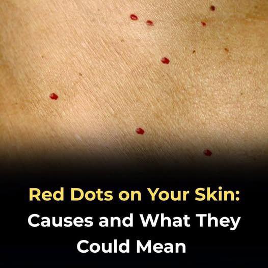 Small Red Dots On Your Skin: What They Could Mean And When To Act — From Harmless Causes Like Cherry Angiomas, Irritation, Or Heat Rash To Allergic Reactions, These Spots Are Often Benign. However, Sudden Spreading, Unusual Changes, Or Accompanying Symptoms May Signal Infection Or Bleeding Issues, Making Prompt Medical Evaluation Important