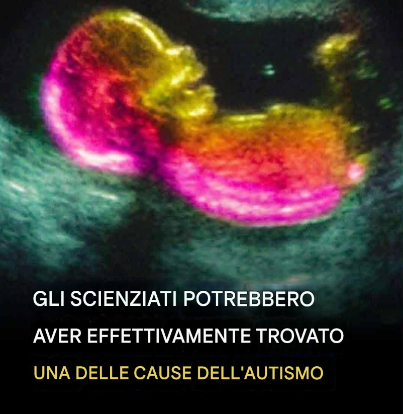 Gli scienziati potrebbero aver effettivamente individuato una delle cause dell’autismo.