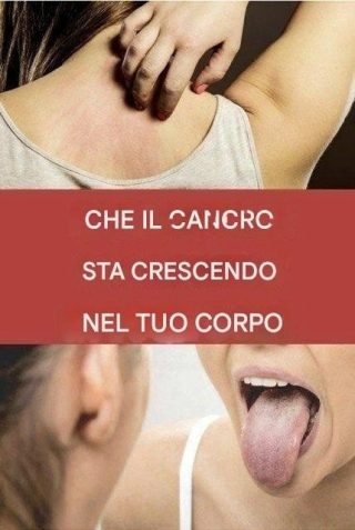 19 possibili segnali di cancro: quando consultare un medico