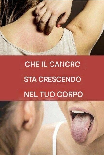 19 possibili segnali di cancro: quando consultare un medico